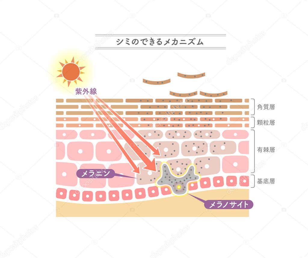 Illustration showing the mechanism of stains.Japanese notation.