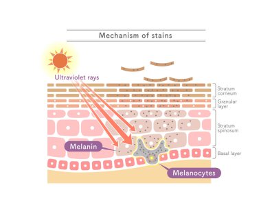 Illustration showing the mechanism of stains.English notation. clipart
