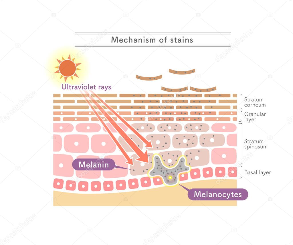 Illustration showing the mechanism of stains.English notation.