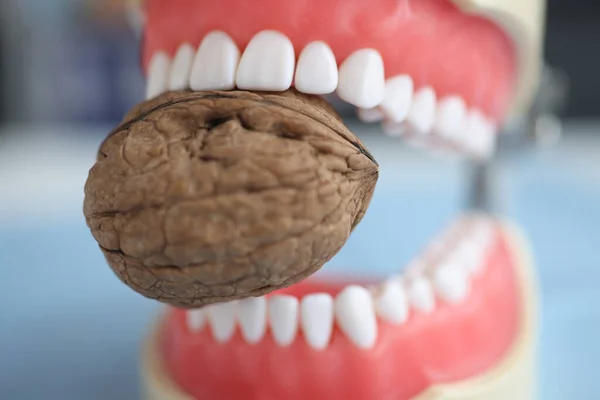Искусственная человеческая челюсть и орех. Сильные крепкие зубы — стоковое фото