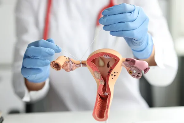 Gynekolog visar hur man ligerar äggledarna på träningsmodell för kvinnliga fortplantningssystem — Stockfoto