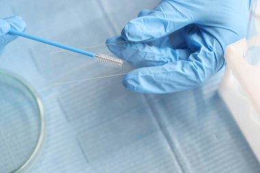 Kadınların vajina lekelerini cam kapaklarına yapıştırıyorum.