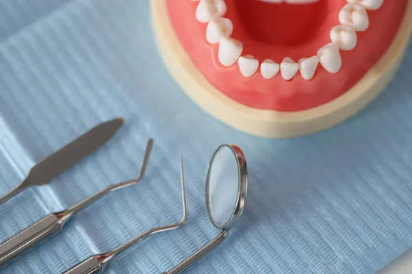 テーブルクローズアップ上の歯科用機器と人工顎 — ストック写真