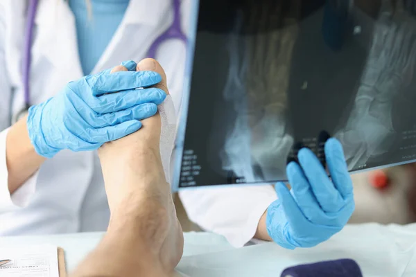 Lékař při pohledu na xray nohy a vyšetření nohy pacienta detailní up — Stock fotografie