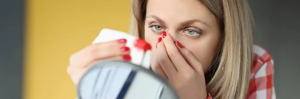 Молодая женщина вытирает нос салфеткой перед зеркалом — стоковое фото