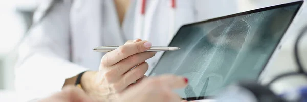 Lékař ukazuje pacientovi rentgen plic na tabletu detailní — Stock fotografie