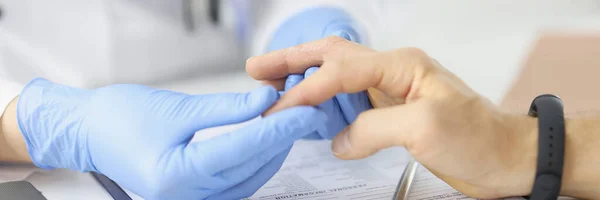 Man with problem of peeling skin on hands at doctor appointment