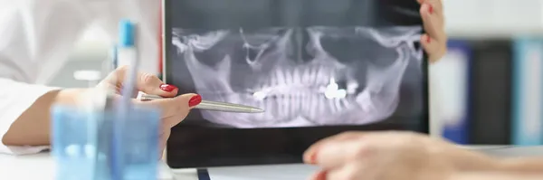 Profesionální zubař ukazuje pacientovi rentgeny čelistí a zubů pomocí digitálního tabletu — Stock fotografie