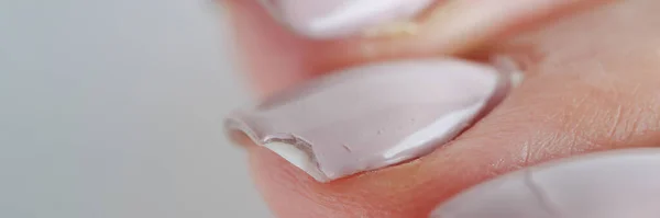 Gebroken vrouwelijke nagels met manicure. Zwakke en broze nagels — Stockfoto