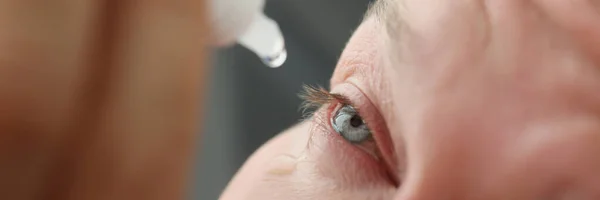 Człowiek z alergią skóry kopie krople do oka — Zdjęcie stockowe