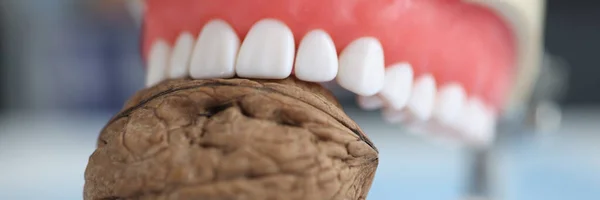 Искусственная человеческая челюсть и орех. Сильные крепкие зубы — стоковое фото