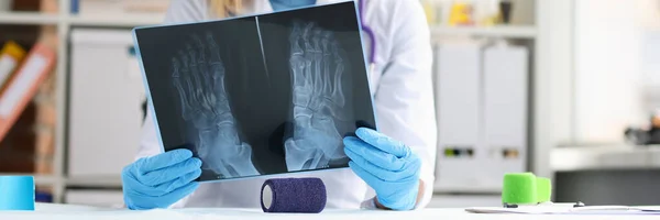 Medico femminile esamina una radiografia della gamba paziente — Foto Stock