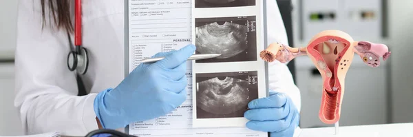 Gynekolog ukazuje ultrazvuk dělohy v kanceláři detailní záběr — Stock fotografie