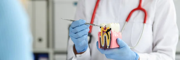 Diş hekimi diş macununun diş minelerini nasıl yok ettiğini gösteriyor. — Stok fotoğraf
