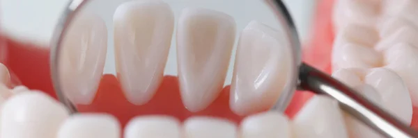 Viewing teeth from inside with dental mirror closeup — Stock Photo, Image