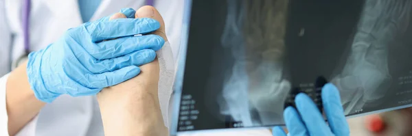 Médico mirando la radiografía del pie y examinando el primer plano de la pierna del paciente — Foto de Stock