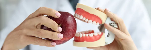 Dentist doctor holds artificial jaw and red apple closeup — Stock Photo, Image