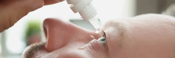 Man druipt antibacteriële druppels in zijn oog close-up — Stockfoto