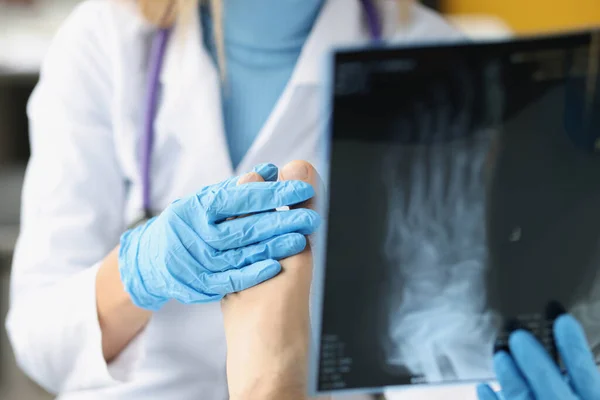 Ženský lékař vyšetřuje rentgen pacientových nohou. — Stock fotografie