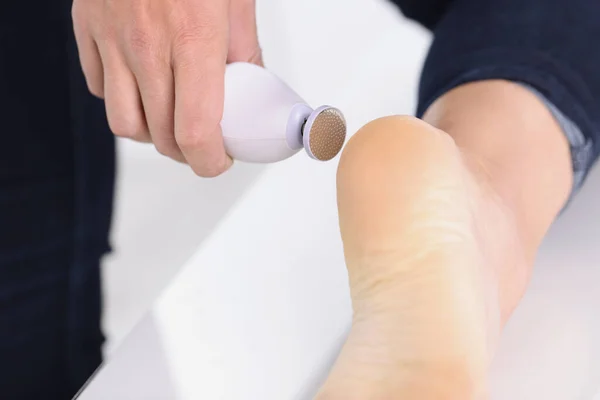 Pedicure e cuidados com os pés. Cuidado do corpo e massagem para pele seca de pés e dedos dos pés — Fotografia de Stock