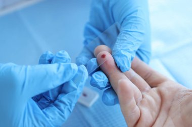 Laboratuvarda cam üzerinde kan örneği olan bir doktor.