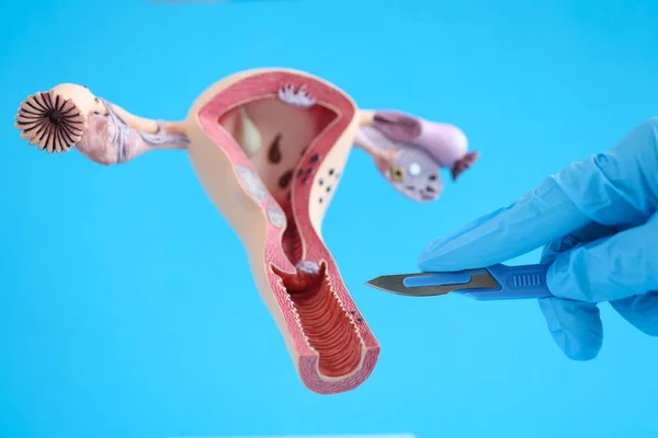 Female reproductive system anatomy uterus and scalpel closeup — стоковое фото