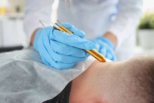 Дерматолог удаляет образования на шее человека с помощью лазера