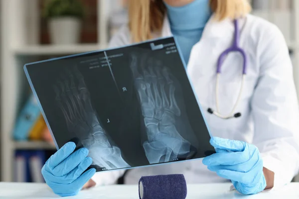 Lékař traumatolog zkoumá rentgen nohy detailní up — Stock fotografie