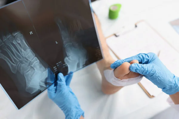 Doctor holds x-ray with dislocated leg of patient lying on table — Foto de Stock