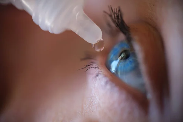 Woman applying eye drops to eye closeup — ストック写真
