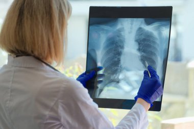 Doctor diagnoses health status of patient with asthma, lung diseases and COVID-19