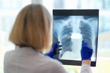 Doktor hastanede röntgene bakar. Radyoloji ve tıp bilimleri alanında uzman. Hastalıklar üzerine çalışıyor.