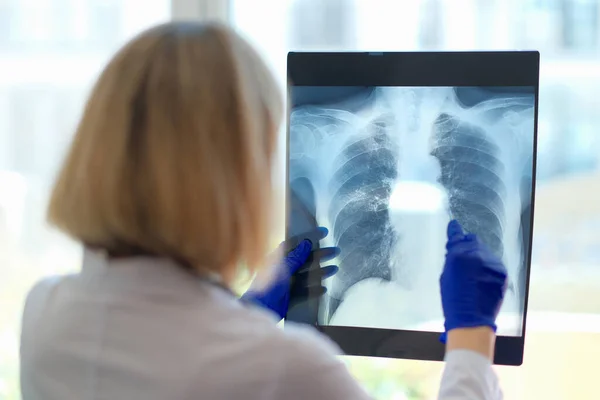 Doktor se dívá na rentgen v nemocnici. Lékařský specialista v oboru radiologie a lékařských věd — Stock fotografie