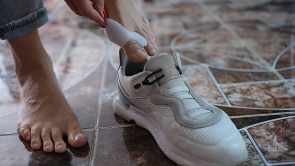 Hallux valgus on women legs with lock puts on sneaker closeup — 스톡 사진