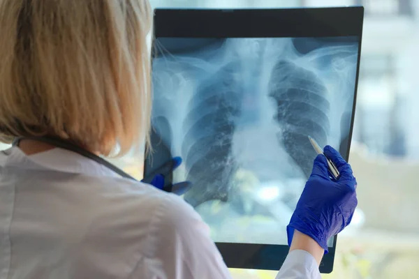 Lékařský asistent nebo radiolog drží ukazatel pro vyšetření a školení na hrudníku — Stock fotografie