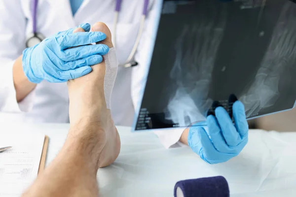 Close Traumatologist Looking Xray Foot Examining Patient Foot Injury First — Stock fotografie