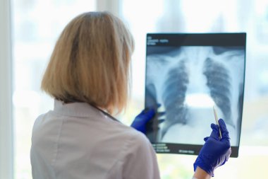 Close-up of doctor pulmonologist examining x-ray photograph of lungs. Radiologist making diagnostic of patient. Medicine and checkup concept