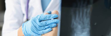 Kadın doktor hasta bacaklarının röntgenlerini inceler. Ayak yaralanması ve burkulma konsepti