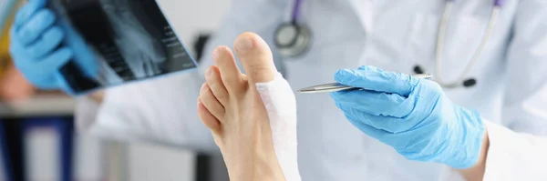 Doctor examines x-ray of dislocated leg of patient lies on table. Foot injury and sprain concept