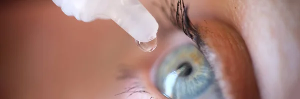 Drops Vial Dripping Woman Eye Closeup Conjunctivitis Treatment Concept — стоковое фото