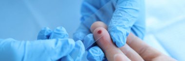 Laboratuvarda cam üzerinde kan örneği olan bir doktor. Kan testi genel biyokimyasal immünolojik kavram