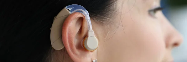Hearing aid is on woman ear. Choosing a quality hearing aid concept