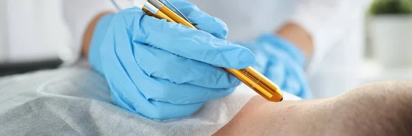 Dermatoloog Verwijdert Formaties Nek Van Een Man Met Laser Verwijdering — Stockfoto