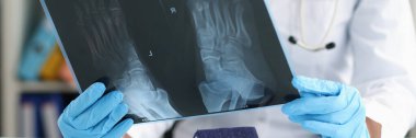 Doktor travmatolog ayak röntgenini inceliyor. Ayak ağrısı ve tedavi kavramı