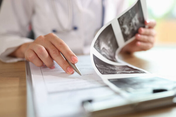 Gynecologist examines results of examination of uterus. Ultrasound diagnostics of pelvic organs