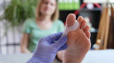 Ortopedi uzmanının kadın hastalar için hallux valgus uygulamasının üst görüntüsü. Ayak ve ilaç konseptinin eklemlerinde bozulma