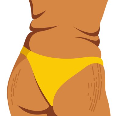 vector image on the theme of body positivity. a curvy girl is not shy of fat folds on her body and stretch marks on her hips. isolated on white background. love and accept your body. love yourself.