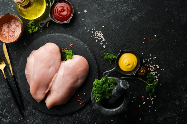 Chicken meat. Raw fresh chicken breast on black slate stone background. Top view. Raw meat.