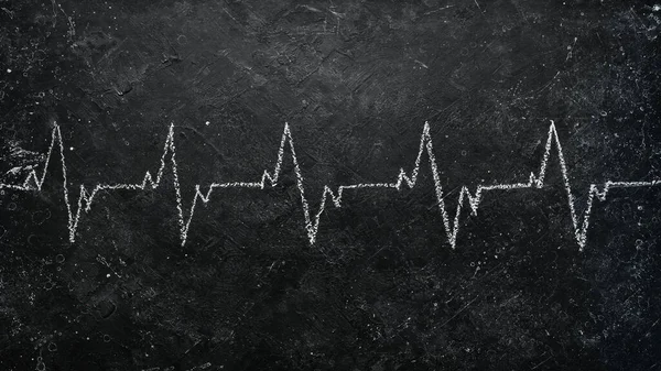 Cardiogramma Del Cuore Disegnato Gesso Uno Sfondo Pietra Nera Vista — Foto Stock