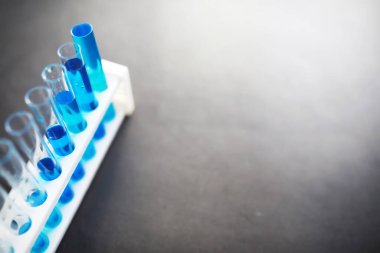 Laboratuvar masasında mavi sıvıyla test tüpü. Sıvının mikroskop altında incelenmesi.